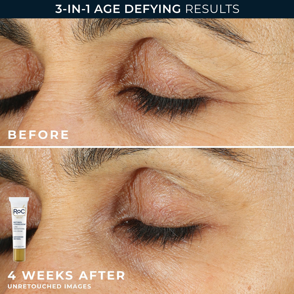 RoC eye cream texture close-up showing delicate smooth application