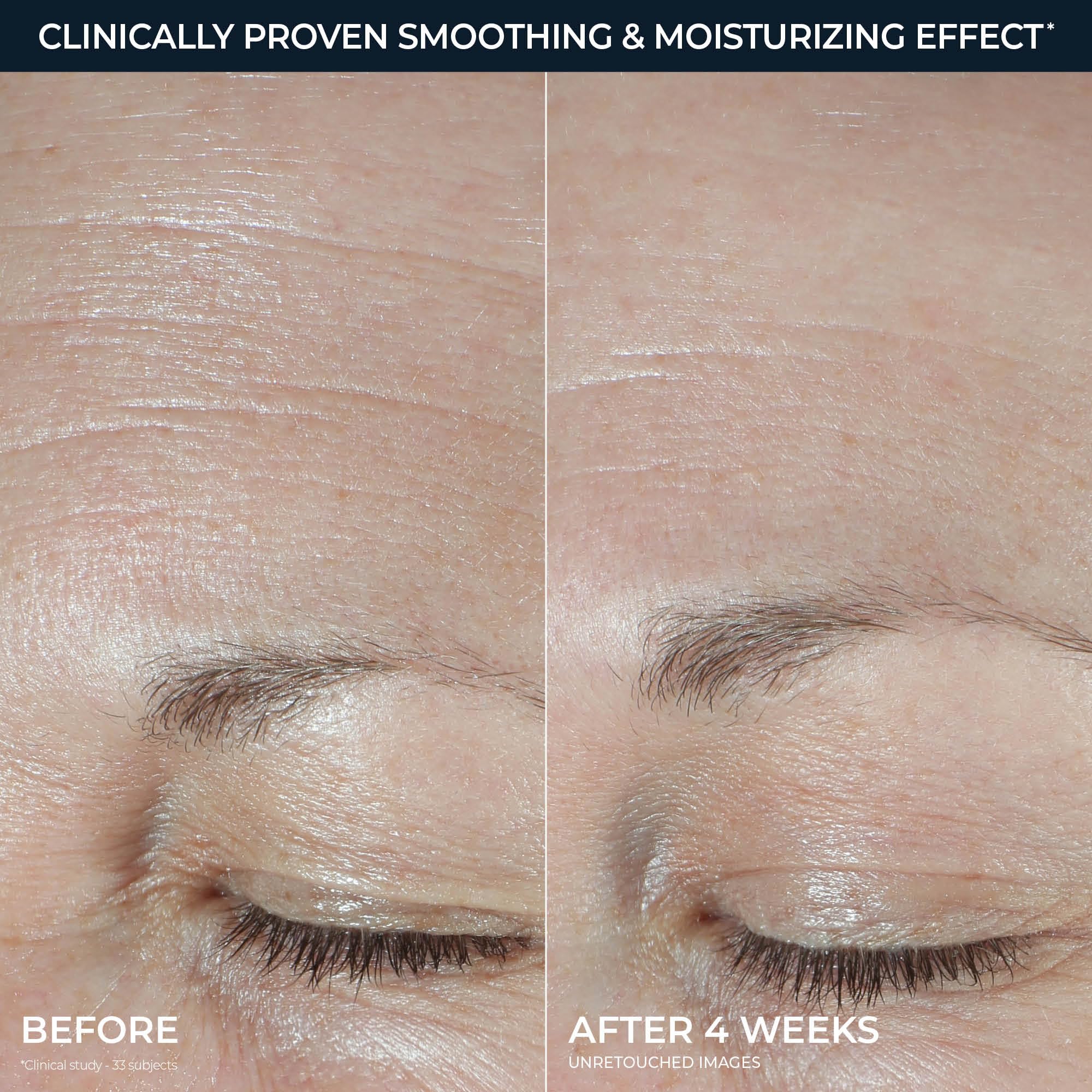 RoC ingredient layout highlighting hyaluronic acids and collagen-support benefit