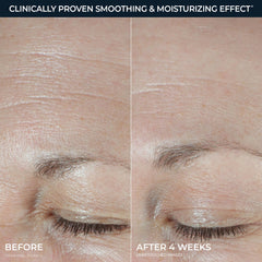 RoC ingredient layout highlighting hyaluronic acids and collagen-support benefit