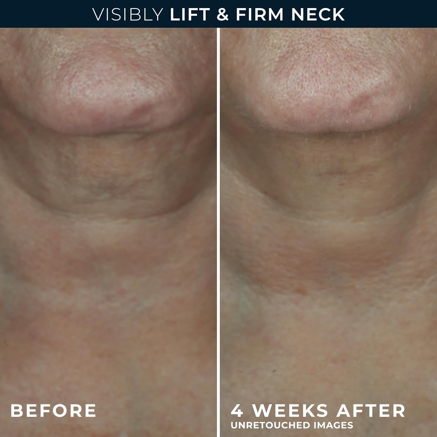 RoC ingredient close-up of hyaluronic acid droplet for visible plumping benefit