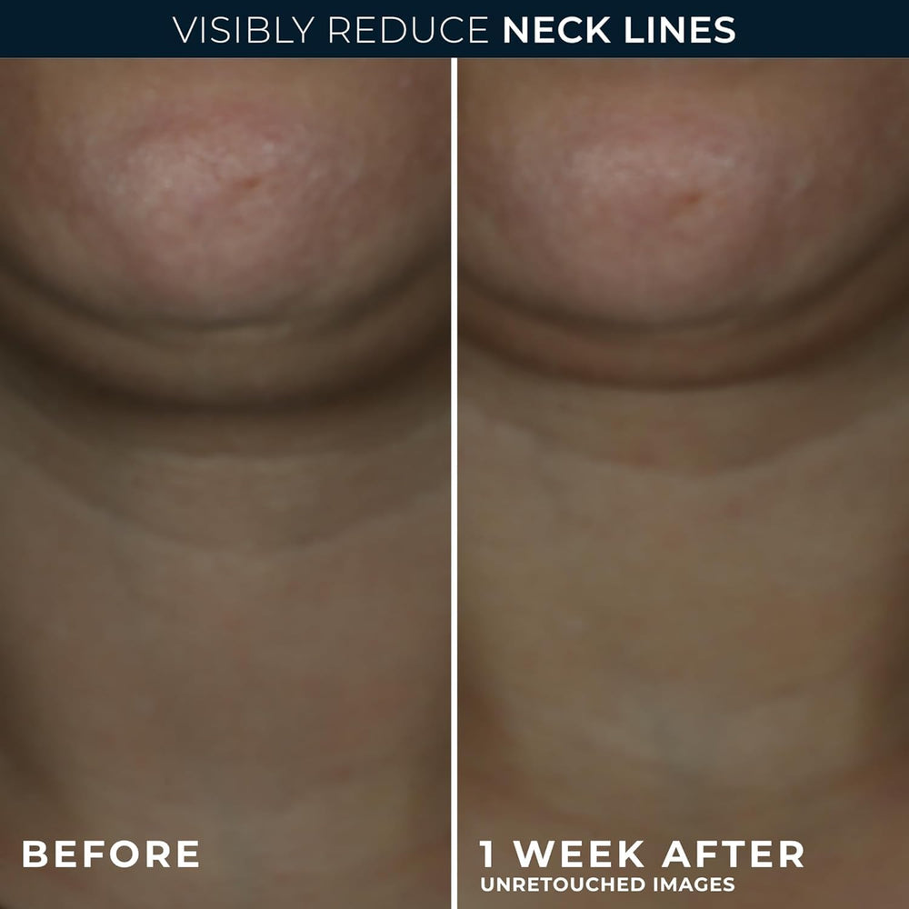 RoC neck cream open jar texture highlighting hydrating smoothness benefit