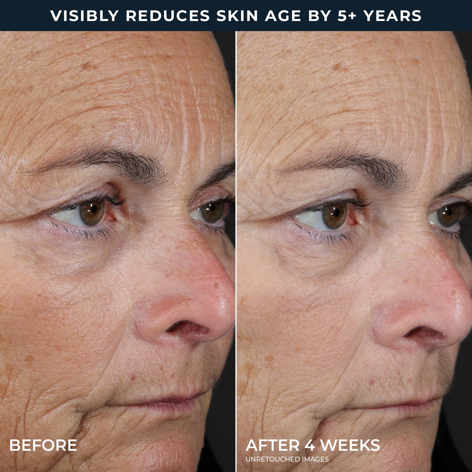 RoC packaging label close-up highlighting key acids and retinol benefit
