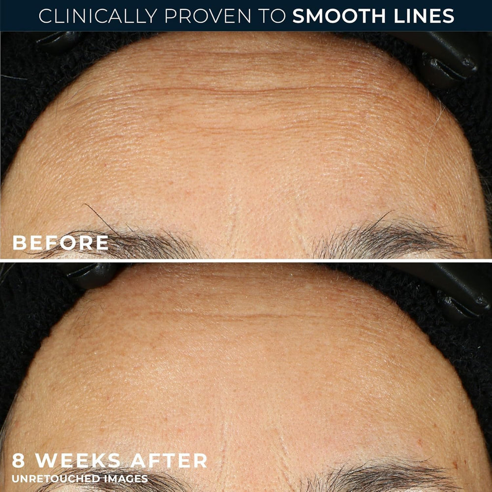 RoC label and ingredients view highlighting clinical retinol transparency