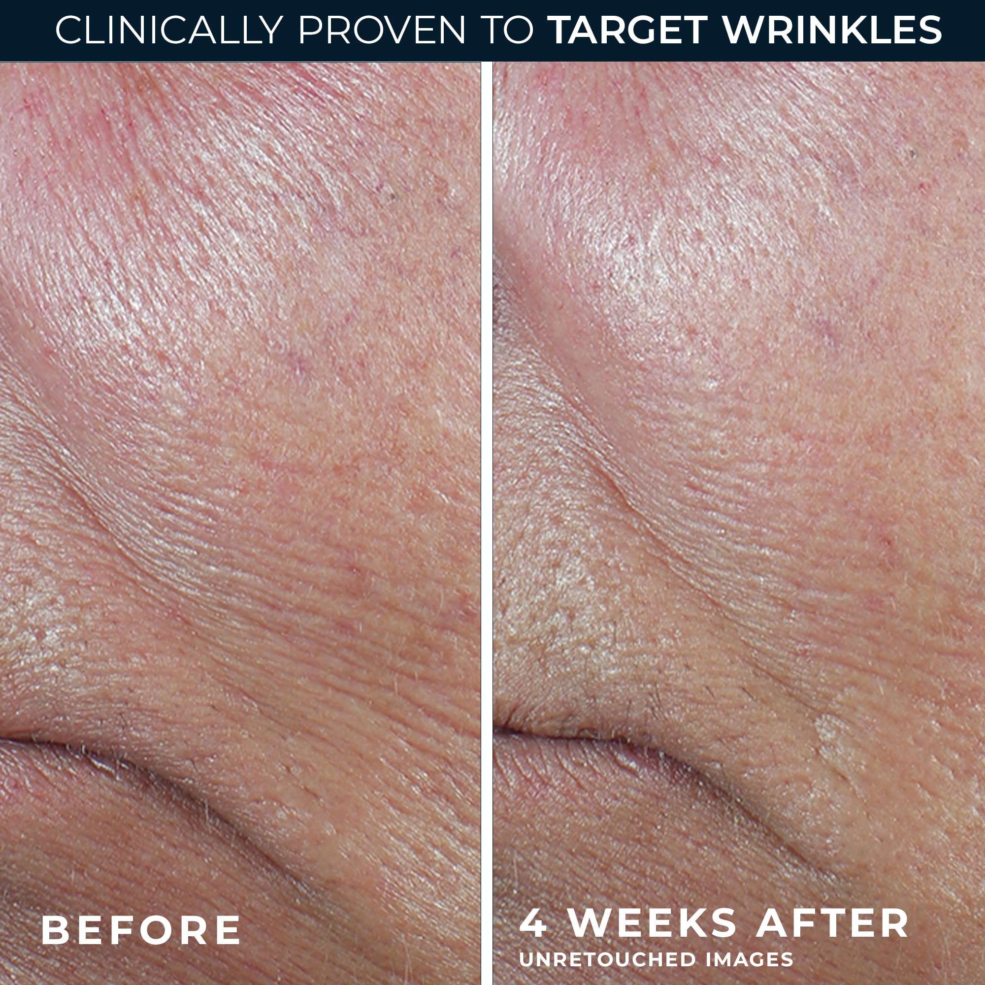 RoC retinol eye cream packette front view showing convenient sample benefit