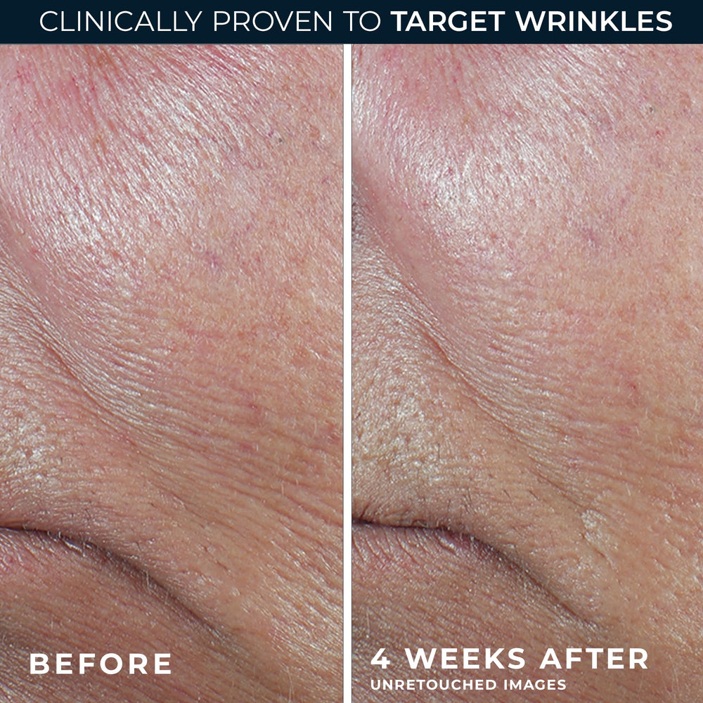 RoC retinol eye cream packette front view showing convenient sample benefit