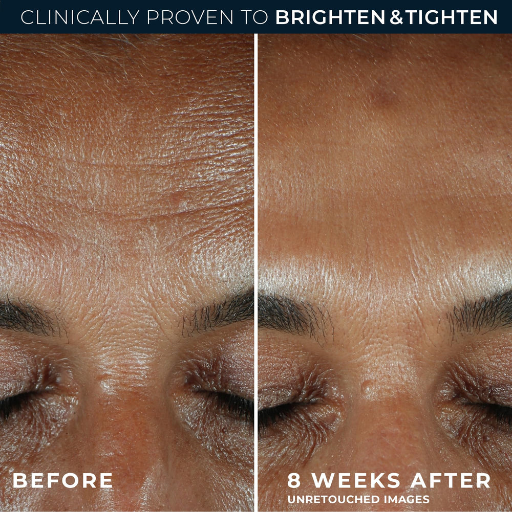 RoC serum applied to model's cheek showing quick absorption and radiant finish