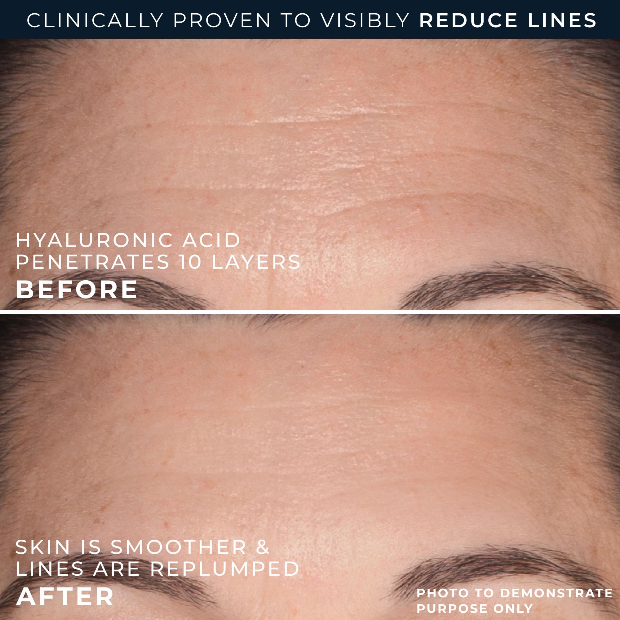 RoC in-use on forehead showing targeted hydration for visible smoothing