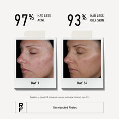 RODAN + FIELDS label close-up highlighting active glycolic ingredient