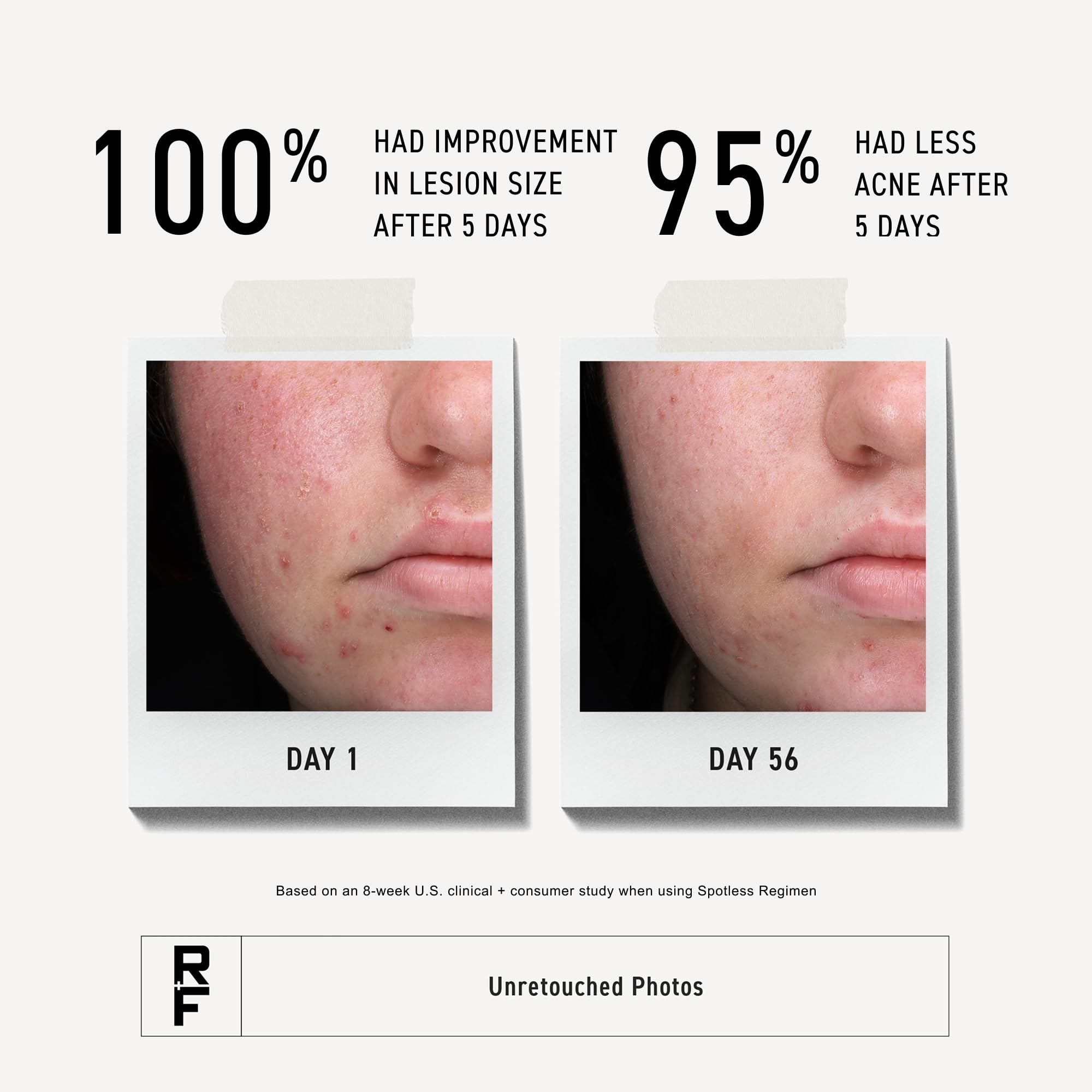 RODAN + FIELDS pump dispense detail showing easy, mess-free application