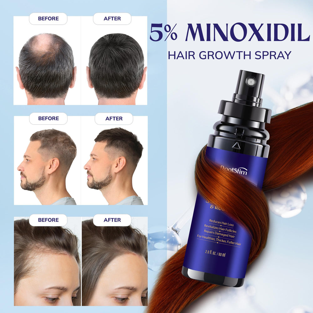 RootStim applied to scalp focusing on targeted coverage and localized support