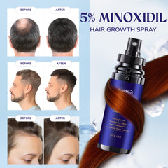 RootStim applied to scalp focusing on targeted coverage and localized support