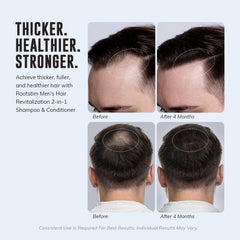 RootStim applied to scalp during massage to boost circulation