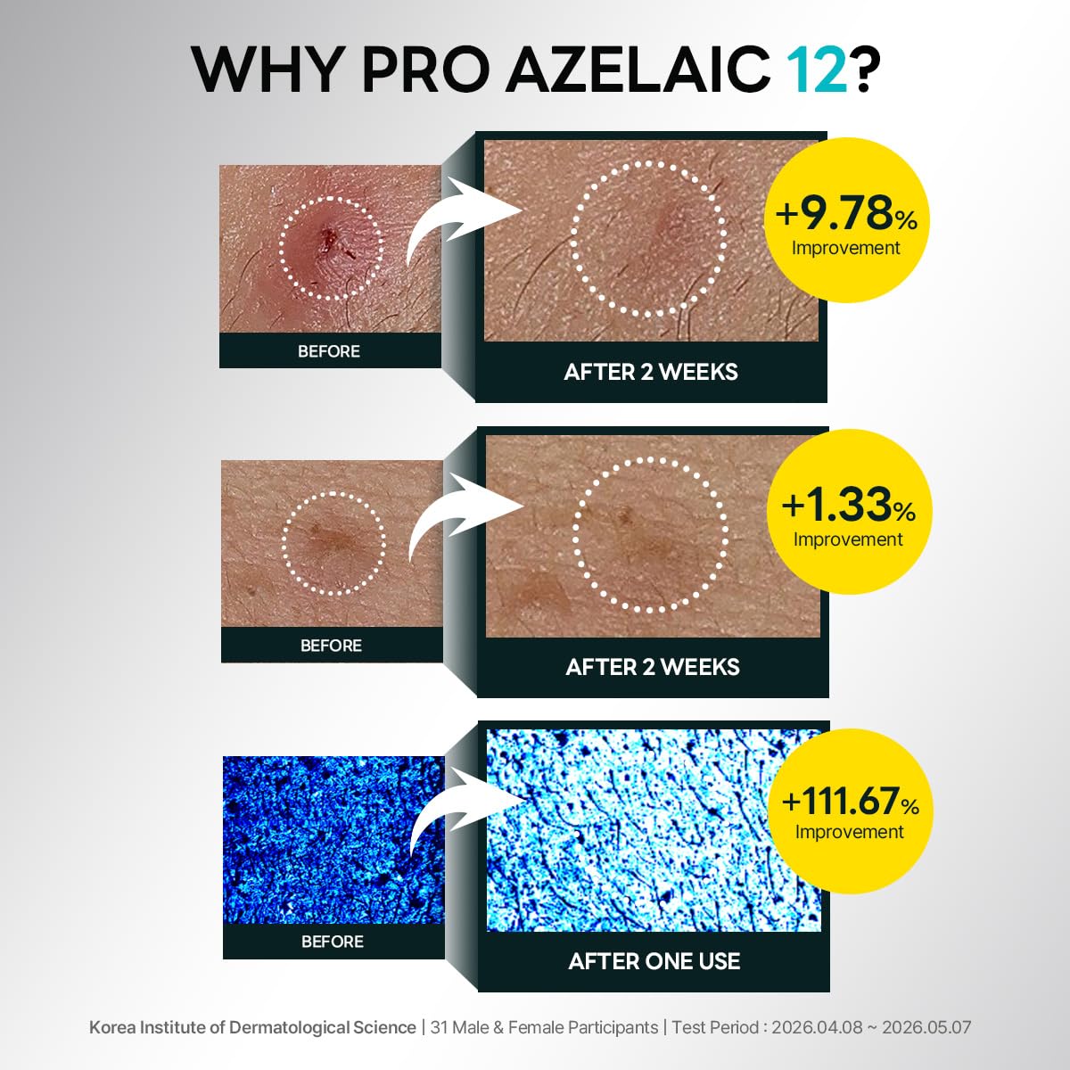 ROUND LAB label close view highlighting azelaic acid, beta-glucan, and hyaluronic blend