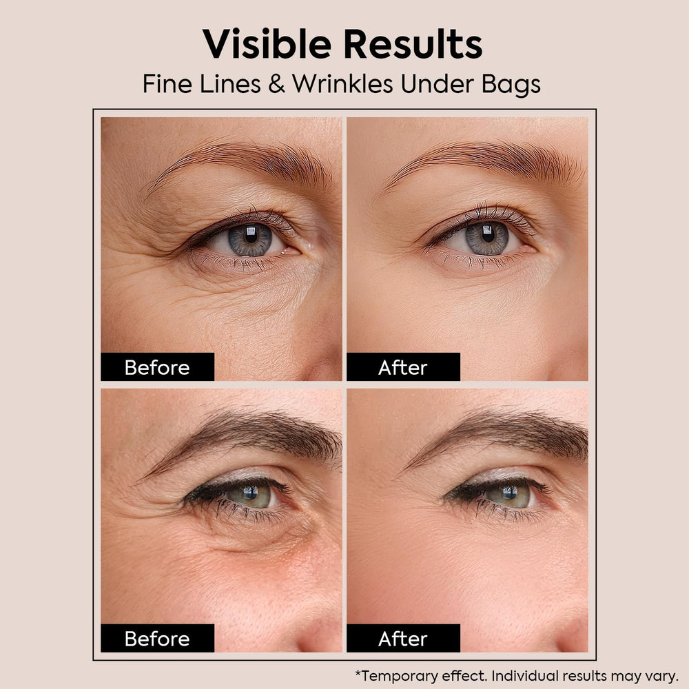Scosvvi cream applied under eye demonstrating reduced puffiness
