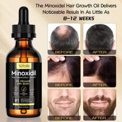 Sefralls applicator applying oil to scalp to demonstrate targeted treatment advantage