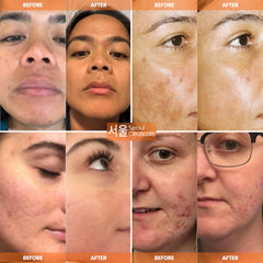 SeoulCeuticals serum texture close-up highlighting lightweight absorbent consistency