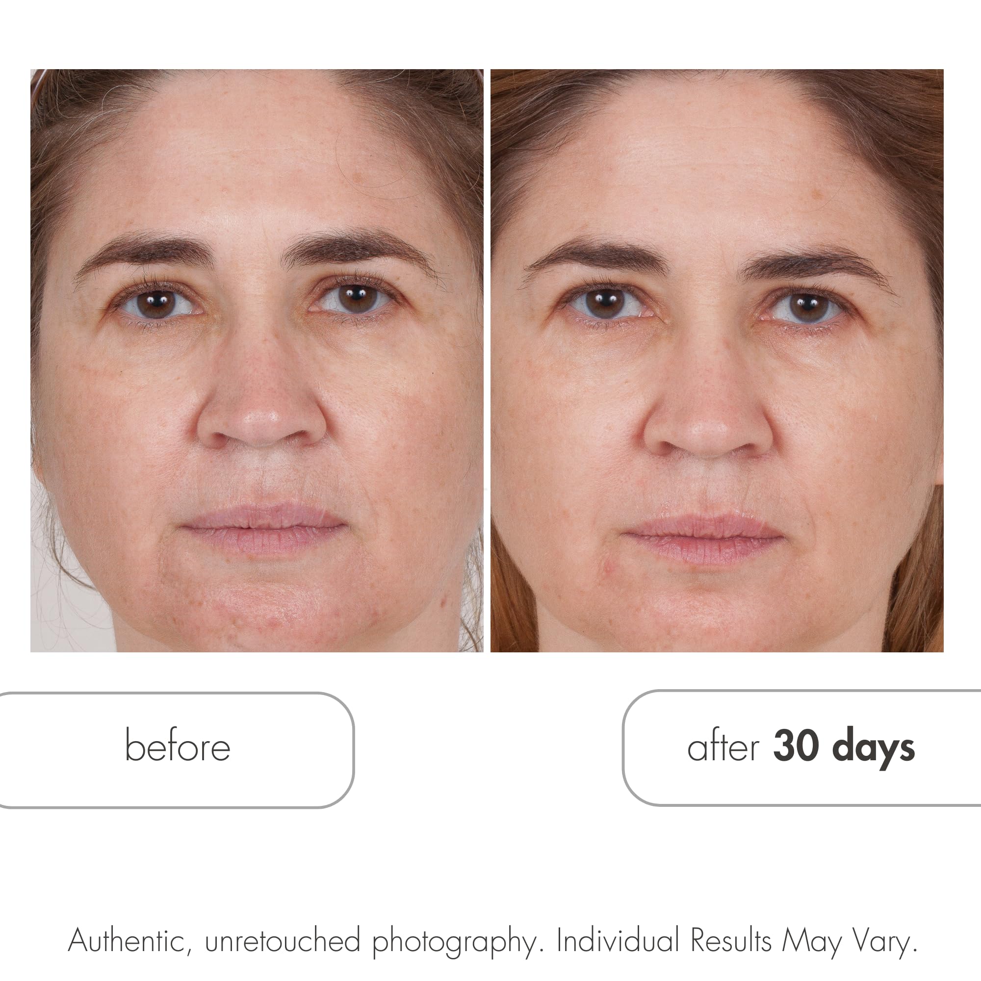 Serious Skincare next to ruler for 12 oz size and value clarity