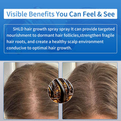 SHLD label close-up listing actives and NDC registration benefit