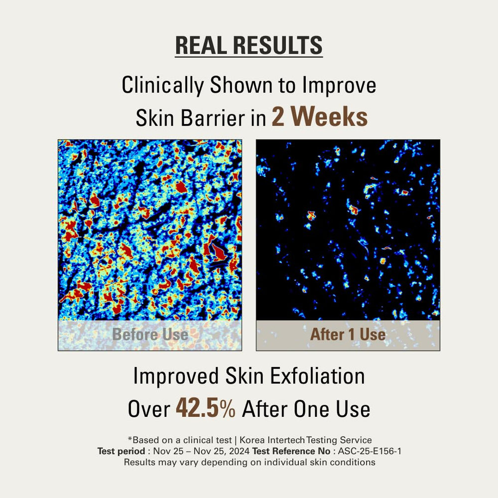 SIOT mask spread on elbow showing body-use, supports smoother skin benefit