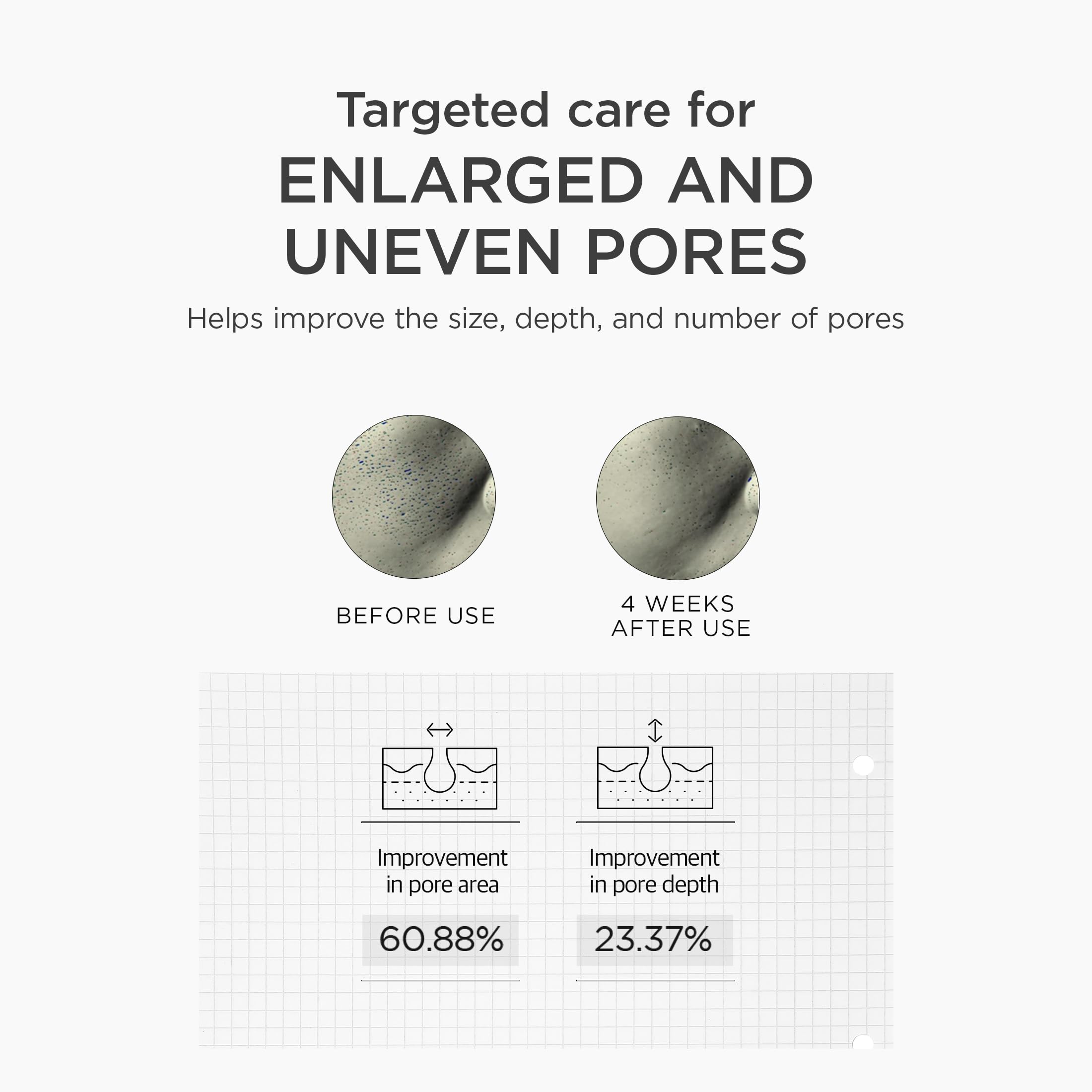 SKIN1004 label closeup highlighting niacinamide and tranexamic acid benefit: ingredient transparency