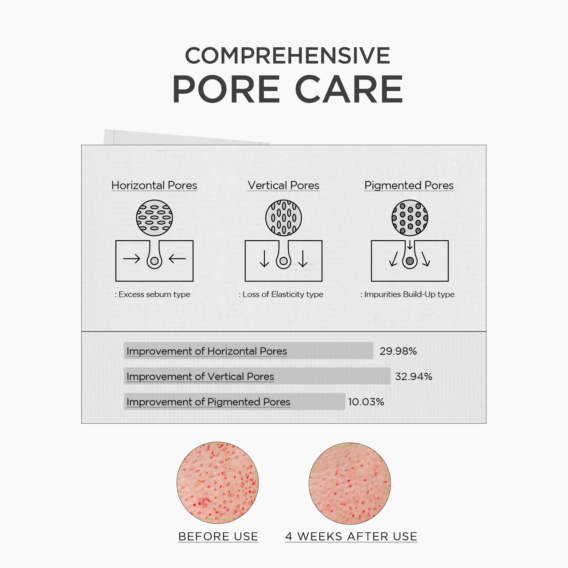 SKIN1004 serum on palm demonstrating lightweight texture benefit: non-sticky hydration