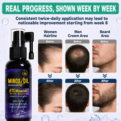 Skinaris biotin and rosemary ingredients highlighting natural support for scalp health