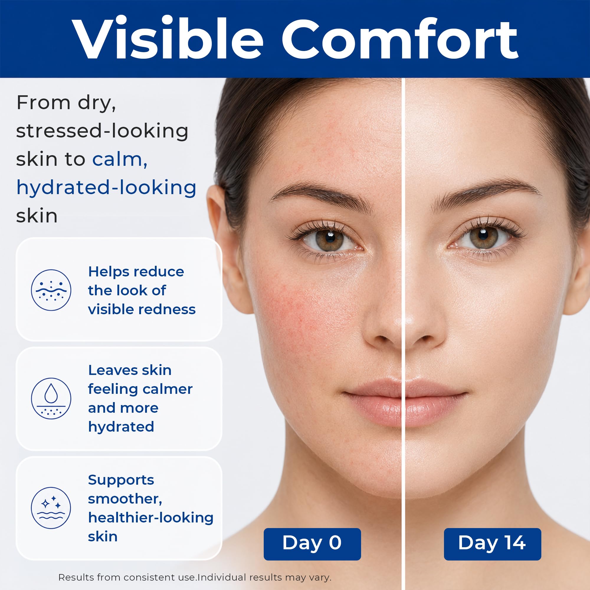 SKINERSE being applied on hand demonstrating fast absorption and soothing effect