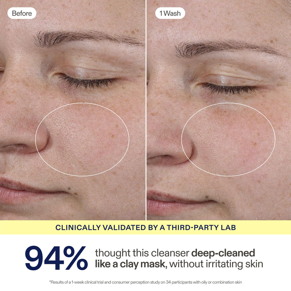 Skinfix bottle label detail showing key ingredients and clean formulation benefits