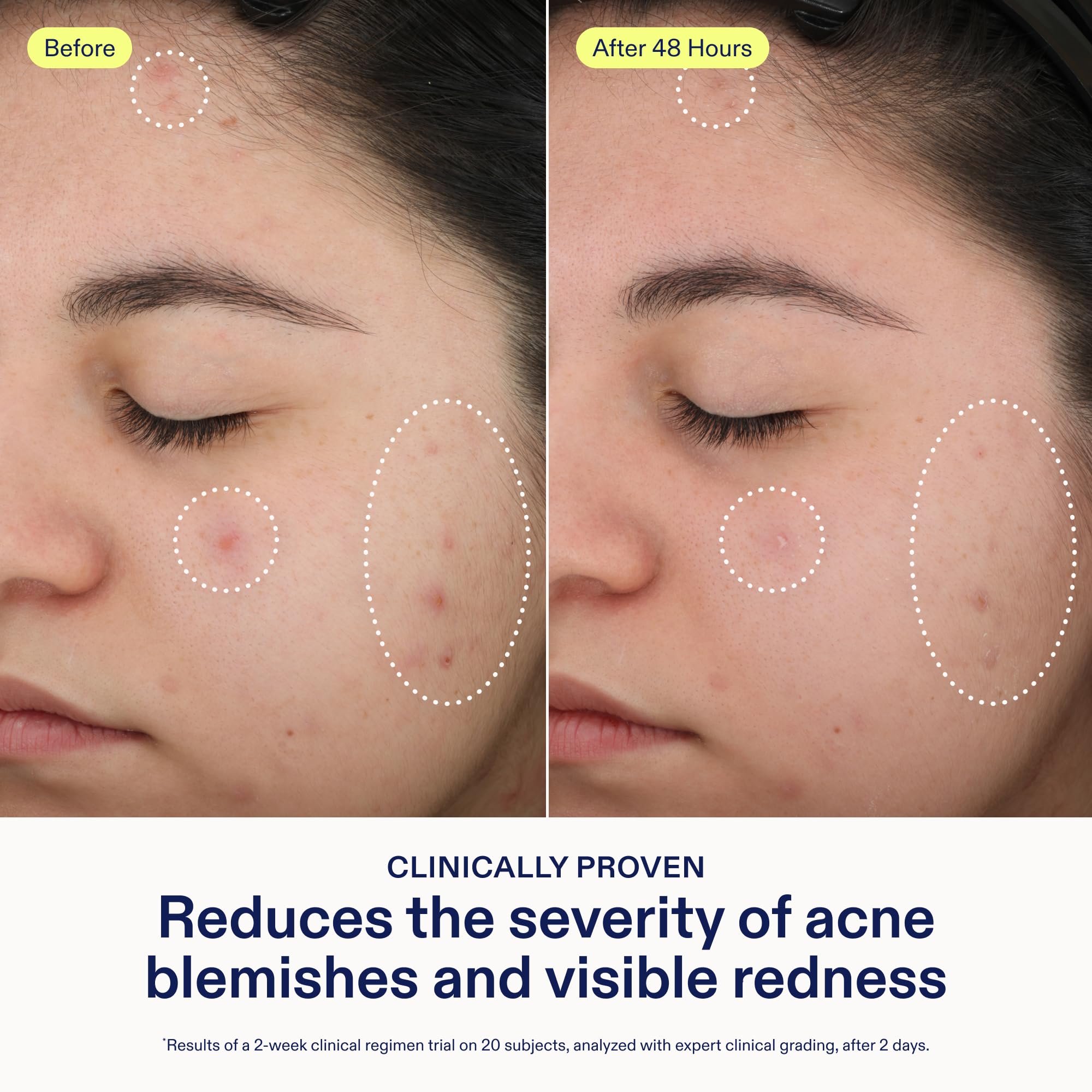 Skinfix texture close-up of serum highlighting lightweight absorbency