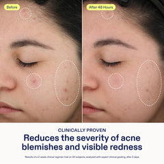 Skinfix texture close-up of serum highlighting lightweight absorbency