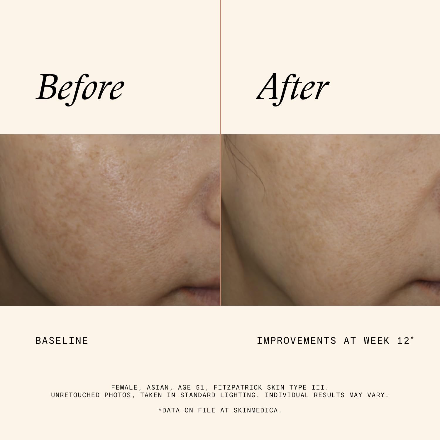SkinMedica label close-up showing ingredients and gentle formula