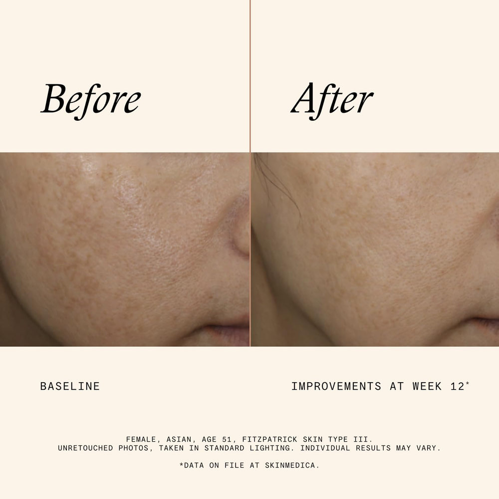 SkinMedica label close-up showing ingredients and gentle formula