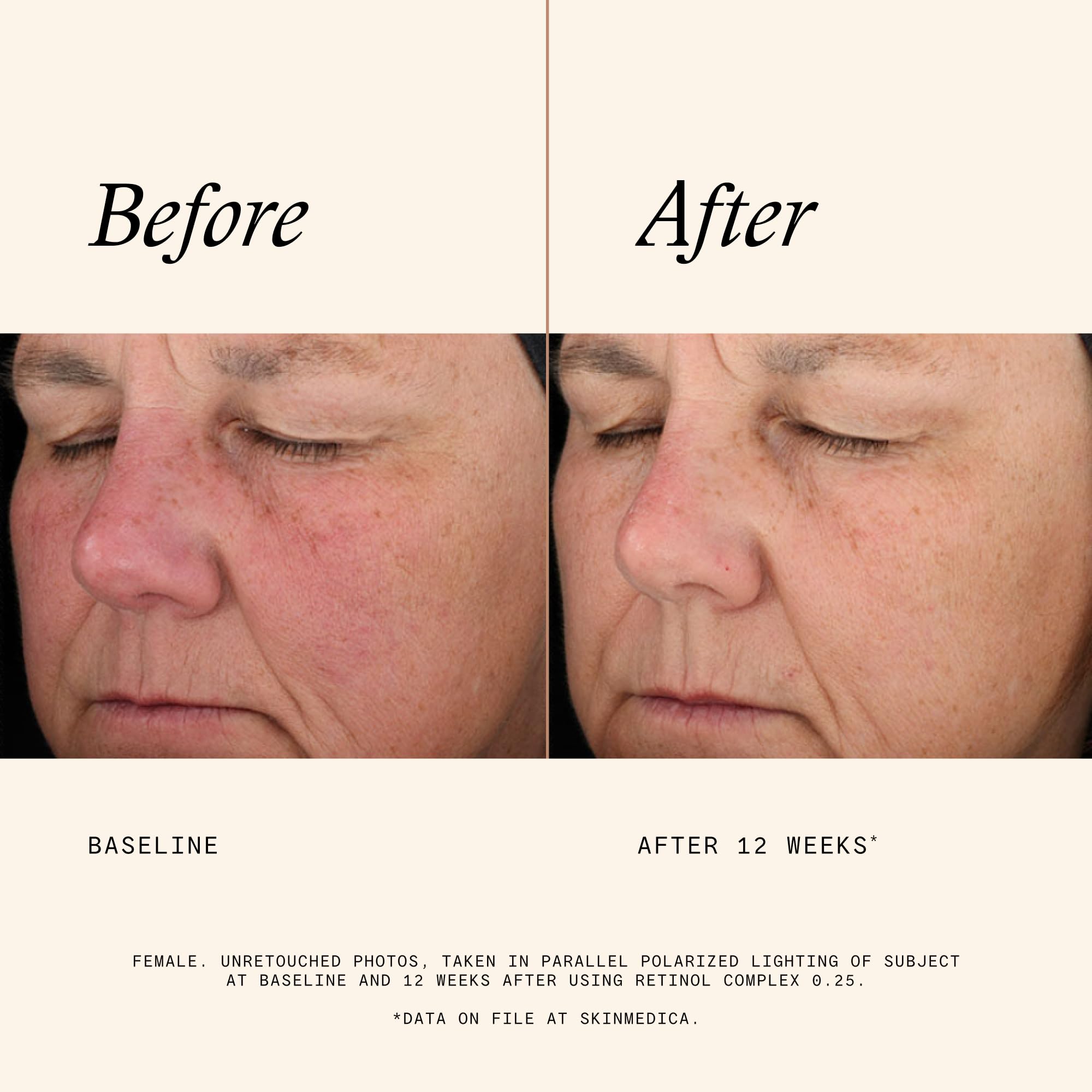 Close-up of SkinMedica serum pouring, emphasizes lightweight absorption benefit