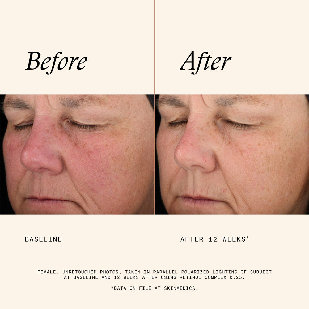 Close-up of SkinMedica serum pouring, emphasizes lightweight absorption benefit