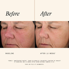 Close-up of SkinMedica serum pouring, emphasizes lightweight absorption benefit