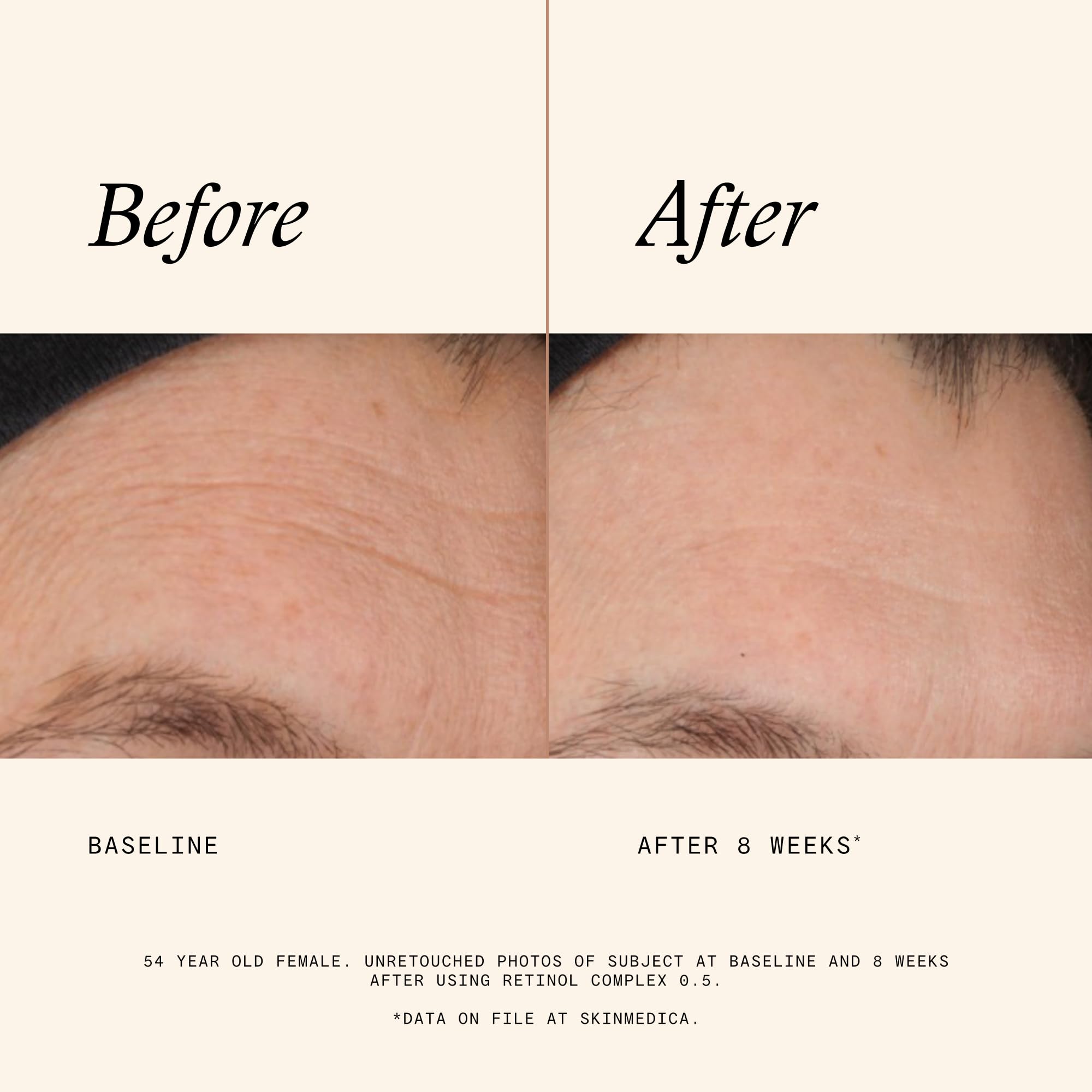 SkinMedica product label and ingredients list emphasizing key actives