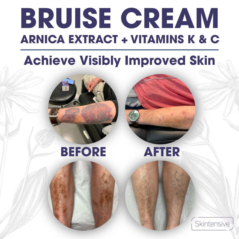 SKINTENSIVE forearm comparison showing improved-looking skin appearance