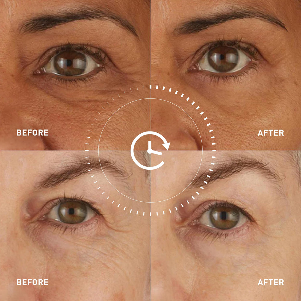 skyn ICELAND ingredient layout with peptides and CoQ10 promoting firming benefits