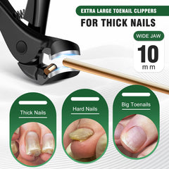 SMZHealing 45° slanted clipper tip for precise ingrown trimming