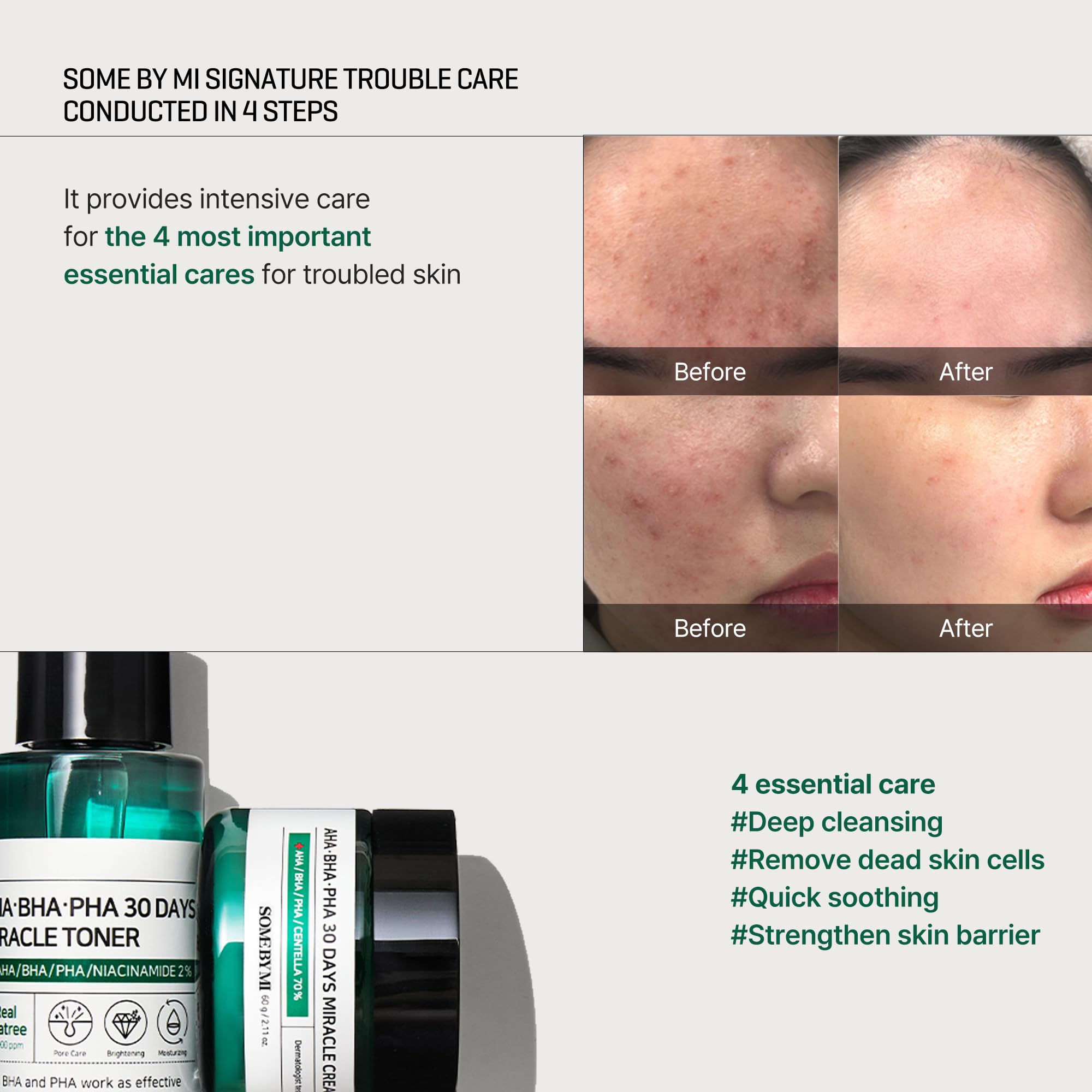SOME BY MI cleansing bar lather detail demonstrating gentle cleansing and moisturization