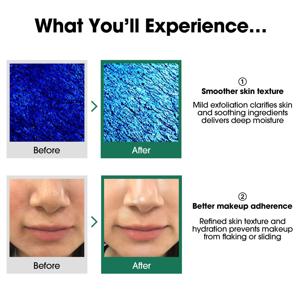 SOME BY MI toner on a cotton pad ready for application to reduce pore buildup