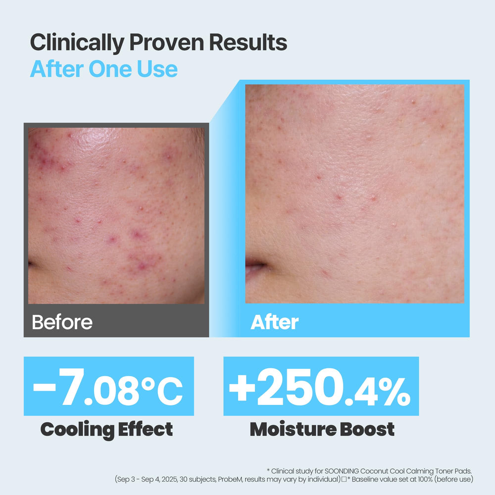 SOONDING pad held in hand applying to face for instant refresh benefit