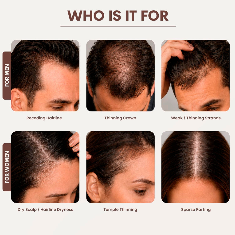 SØREN device in use tapping scalp to deliver serum where needed
