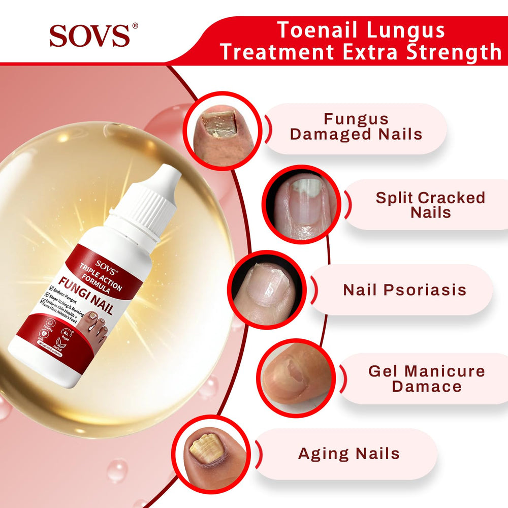 SOVS close-up nail texture highlighting smoother surface and improved appearance