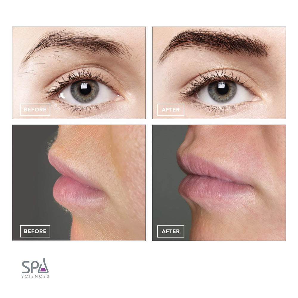 Spa Sciences AIVA used on upper lip area for smooth makeup-ready skin