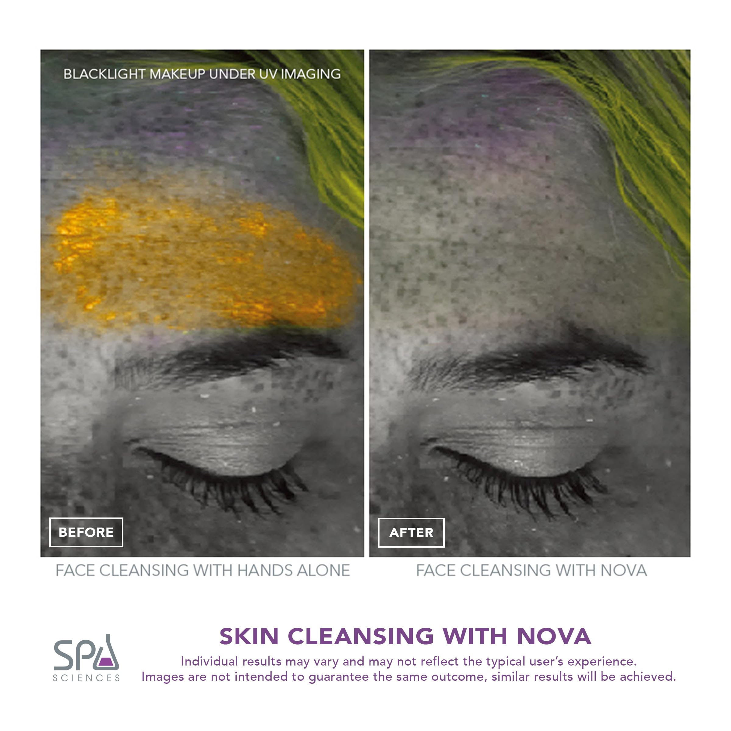 Spa Sciences NOVA in use applying serum to face for enhanced product absorption