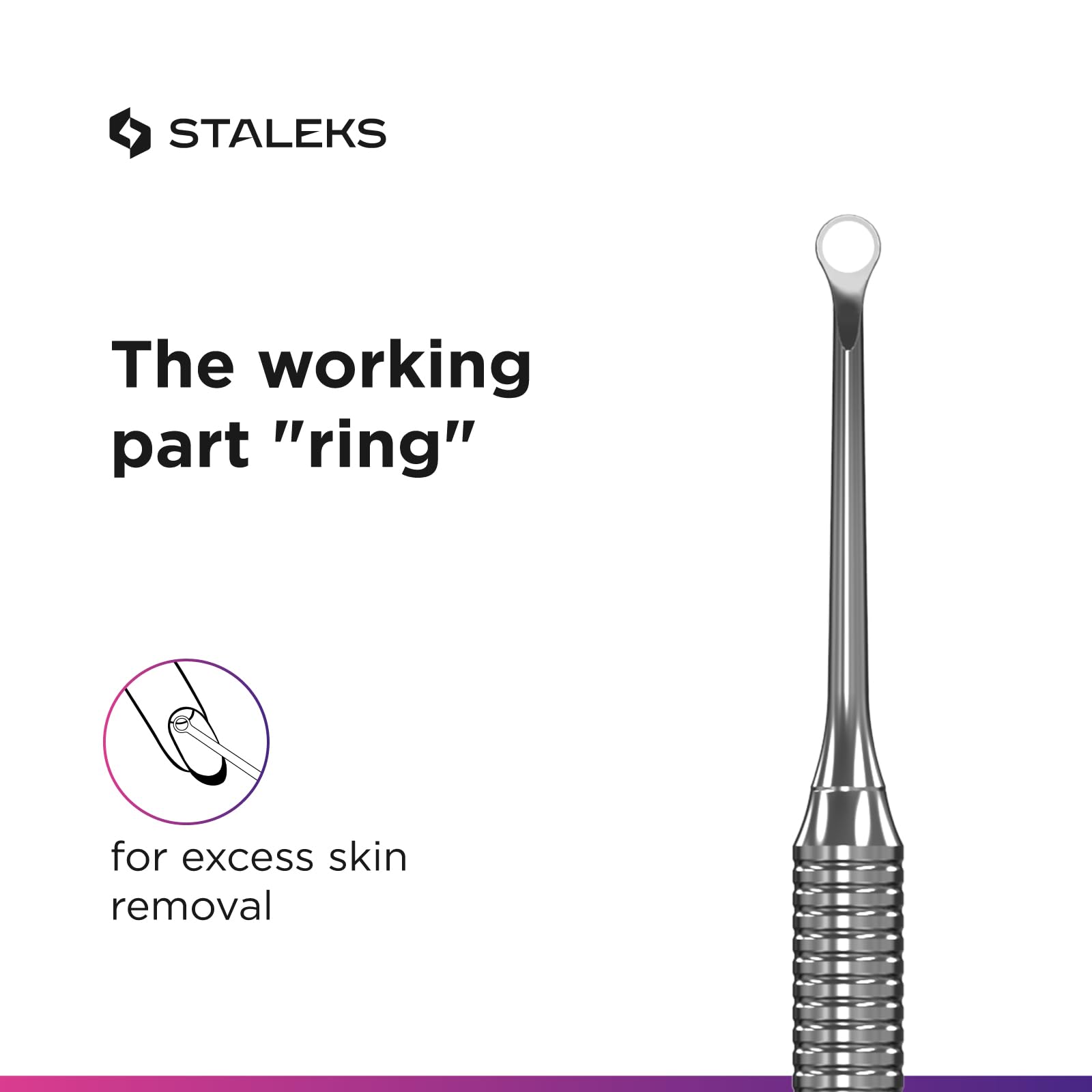 Staleks loop end detail showing rounded contour to remove pterygium safely