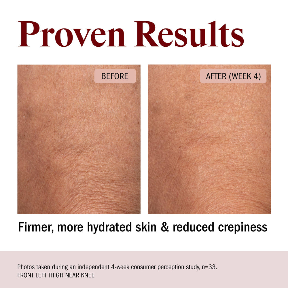 STRIPES application on forearm demonstrating easy spread and immediate hydration