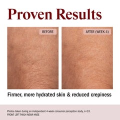 STRIPES application on forearm demonstrating easy spread and immediate hydration