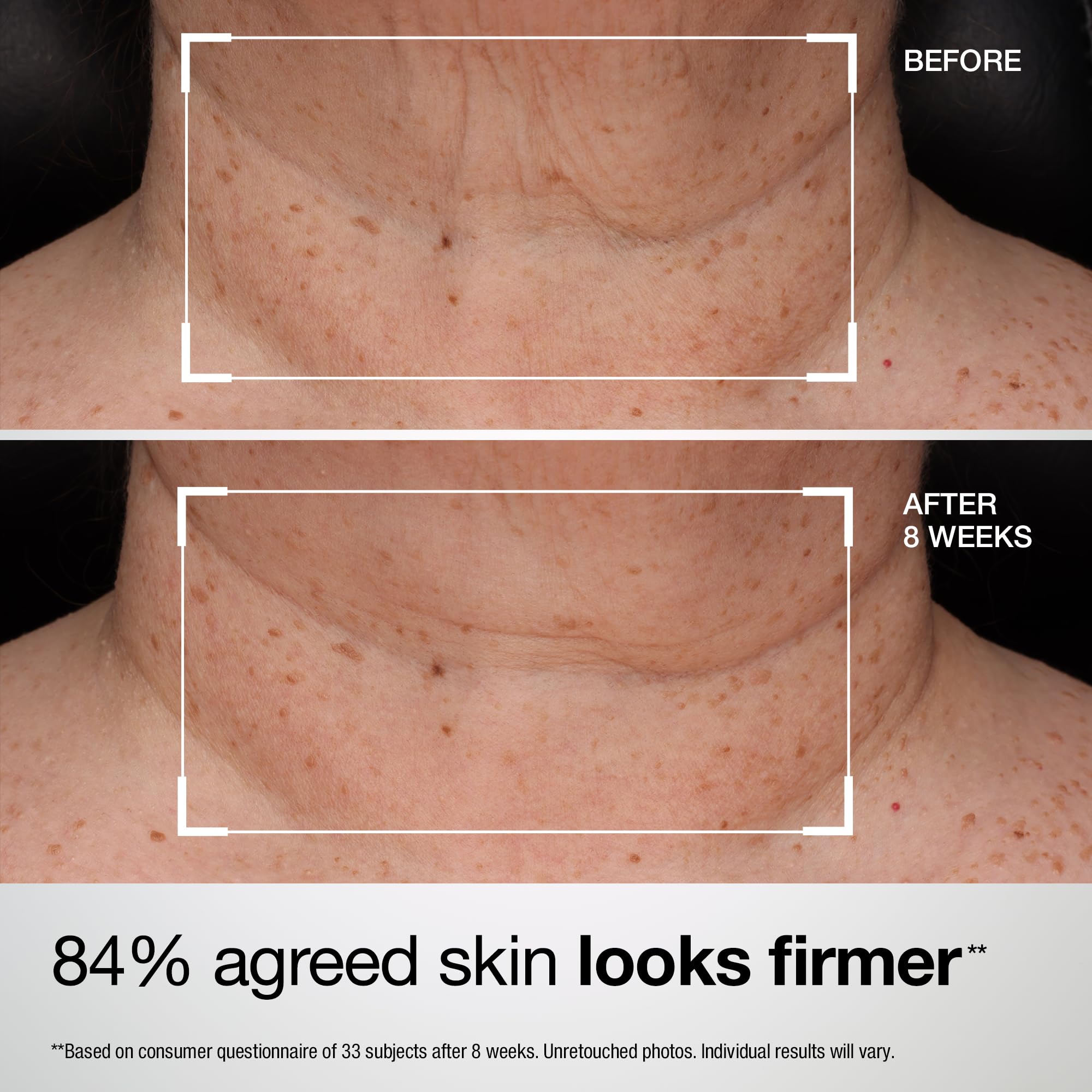 StriVectin lotion applied to chest showing hydration and even-toned look